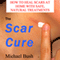 The Scar Cure: How to Heal Scars at Home with Safe, Natural Treatments (Unabridged) audio book by Michael Bush