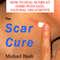 The Scar Cure: How to Heal Scars at Home with Safe, Natural Treatments