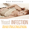Yeast Infection: Discover What Is Yeast Infection and How It Affects Women Health (Unabridged) audio book by Rod Hatfield